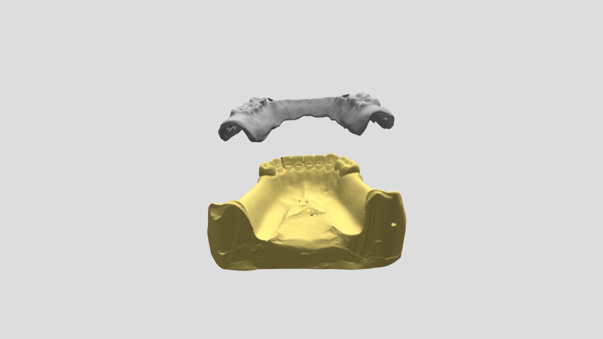 Linguloplate