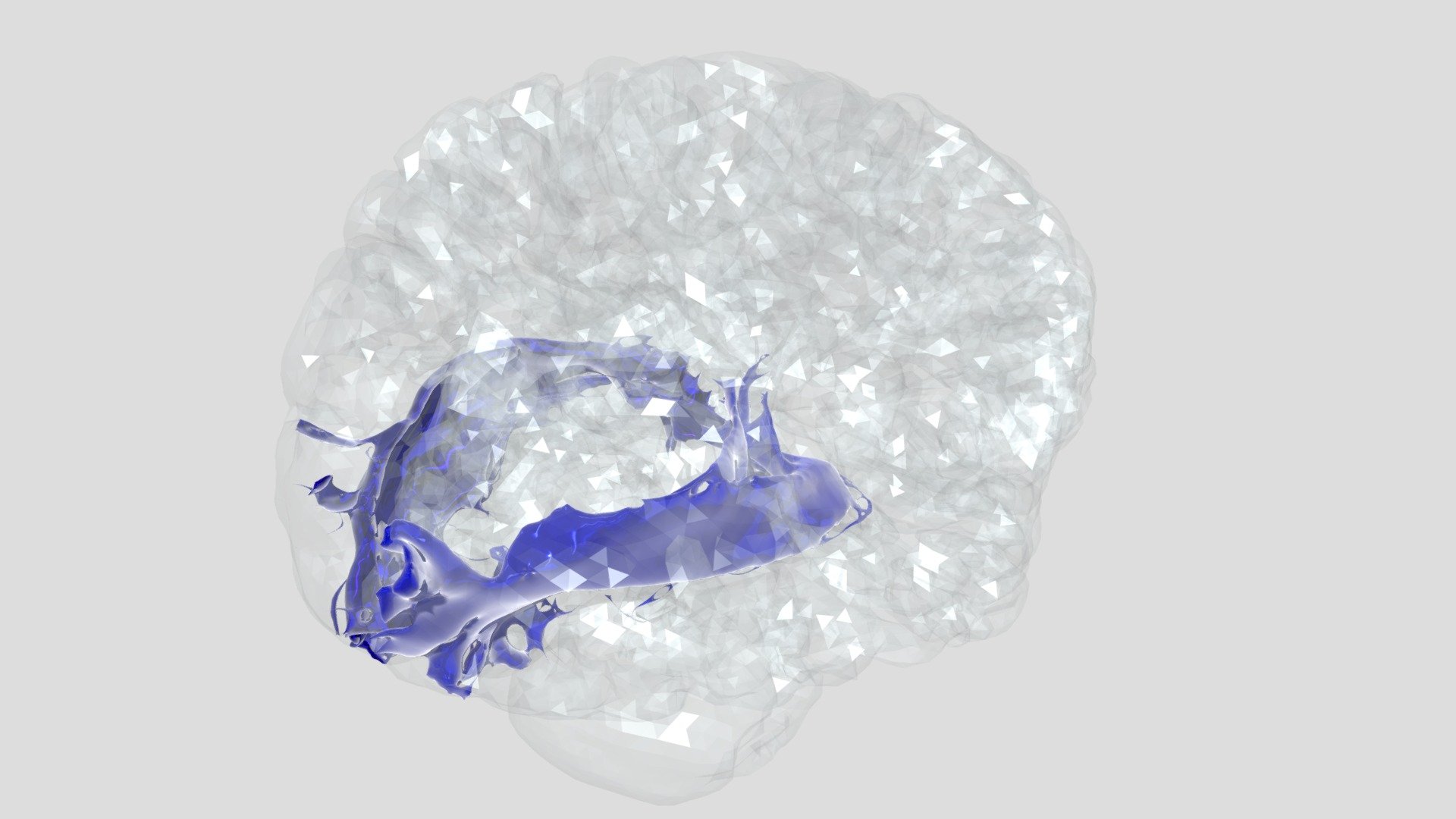 Your Optic Radiations — Sketchfab embed 3D viewer