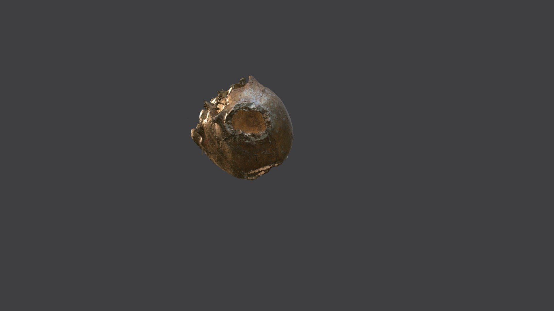 Hemangioma (paleopathological case) — Sketchfab embed 3D viewer