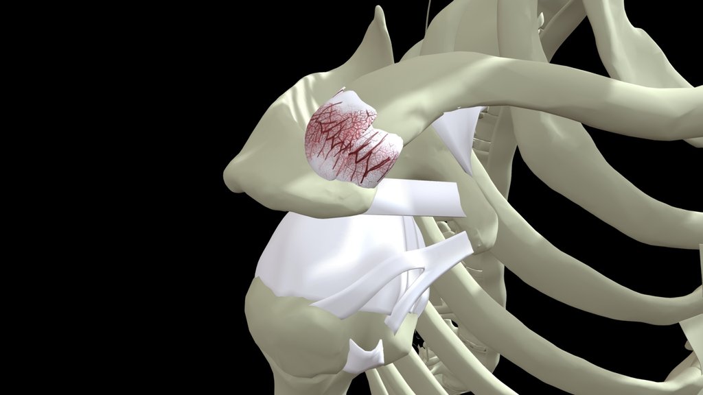 IU School of Medicine - MSK Injuries - A 3D model collection by IU ...