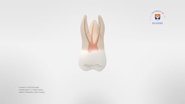 Maxillary First Molar with Two Root Canals – Modello 3D gratuito STL