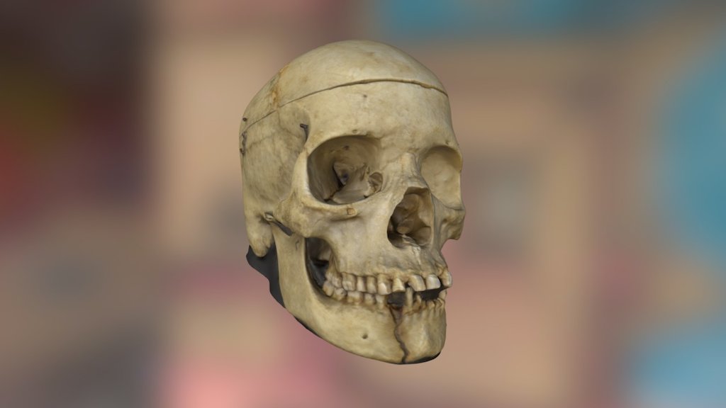 Medical Skull - Remake