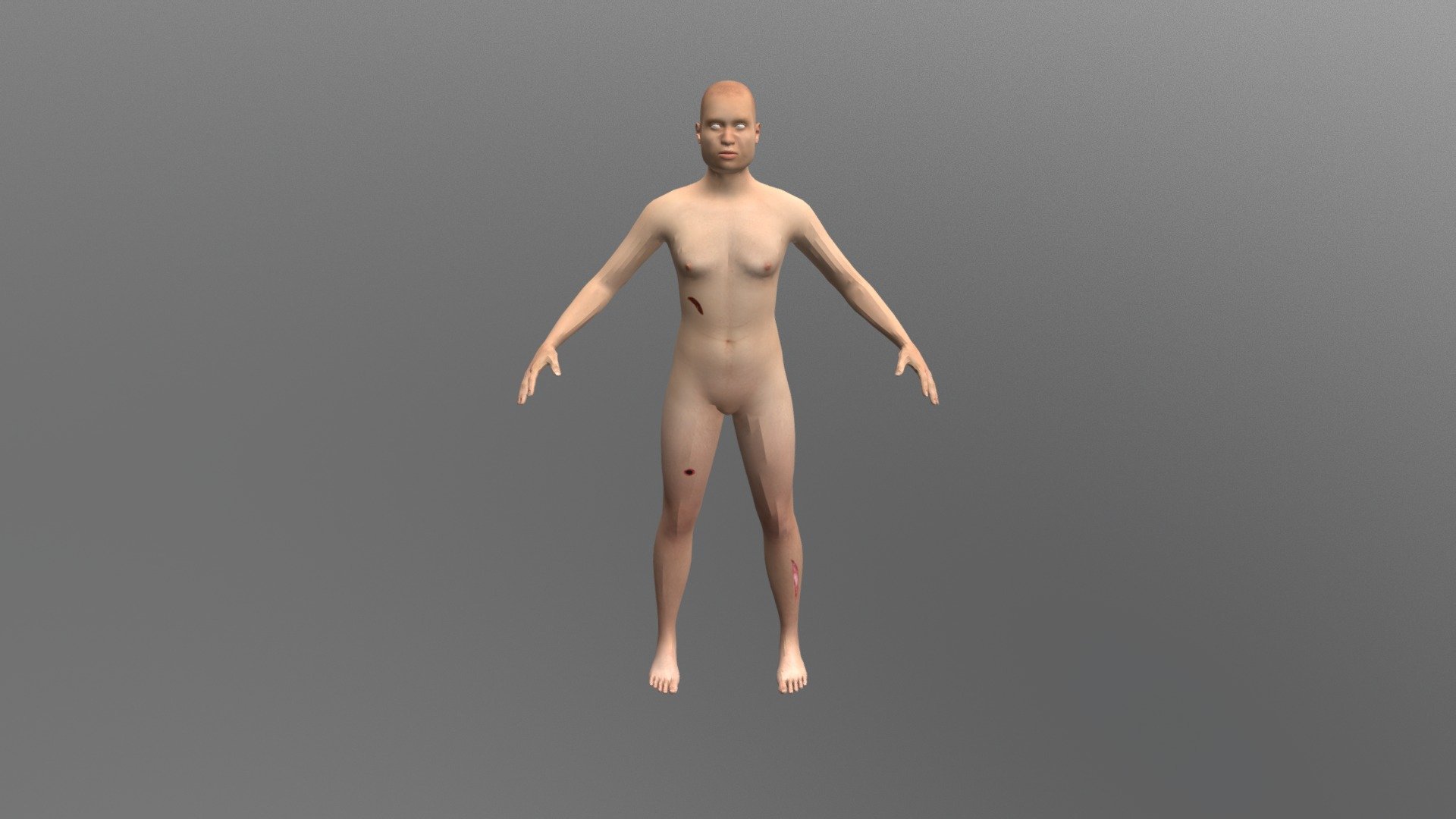 Injured 3D Body Mapping Model