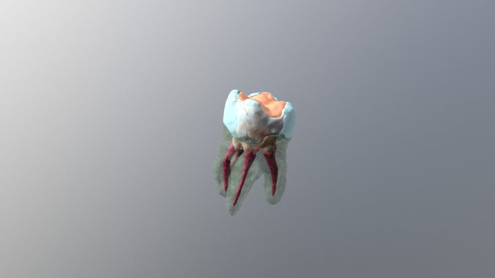 Tooth4part 3D Model