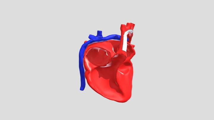 Extracardiac Post Fontan Model 3D Model