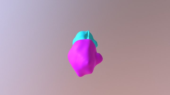 Tumors 3D Model