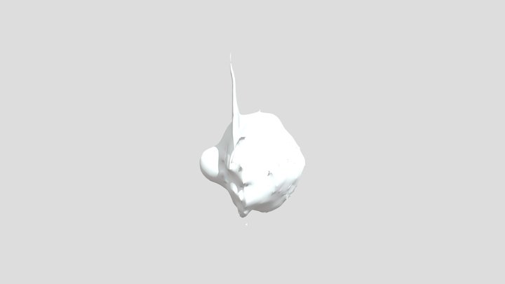 brain tumor 2 3D Model