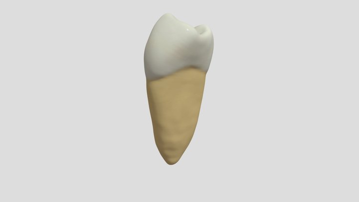 Mandibular Second Premolar (Right)