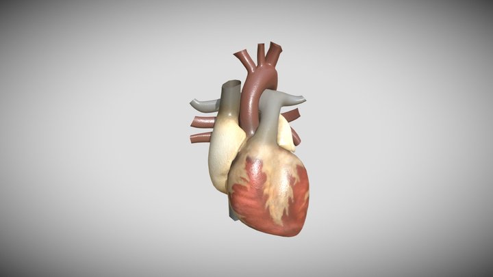 Heart Atrial Fibrillation 3D Model