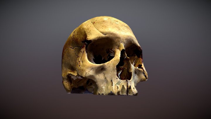 Calavera Trepanación 3D Model
