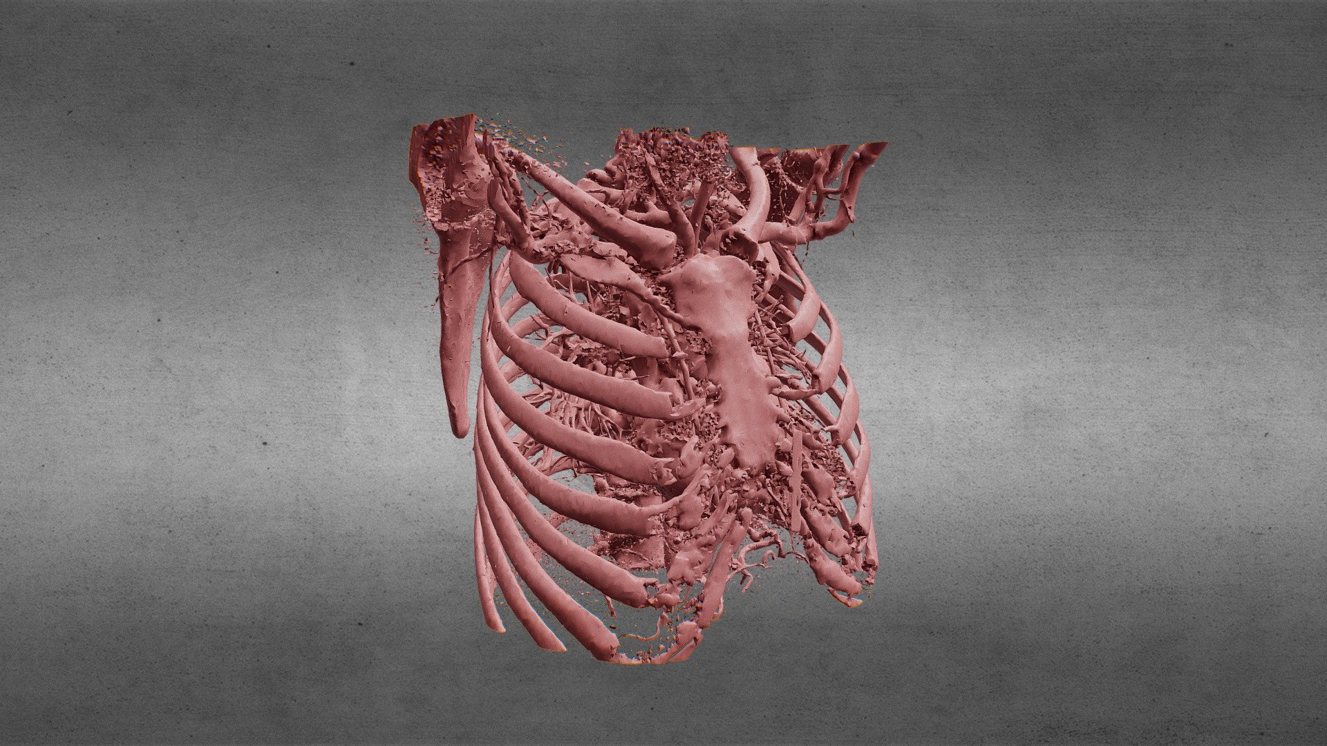 CAT Scan to 3D - Torso