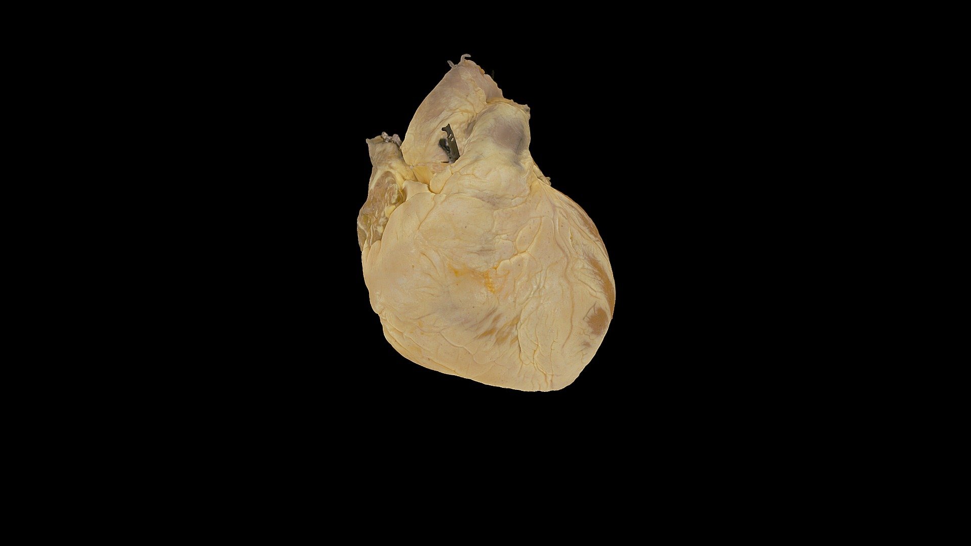 Perfusion Fixed Human Heart #0229