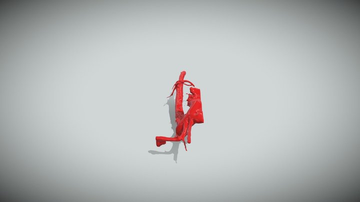 AORTA 3D Model