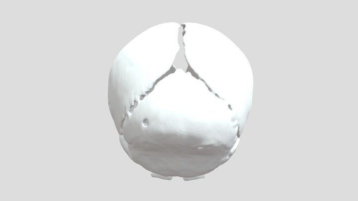 Normal Skull 3D Model