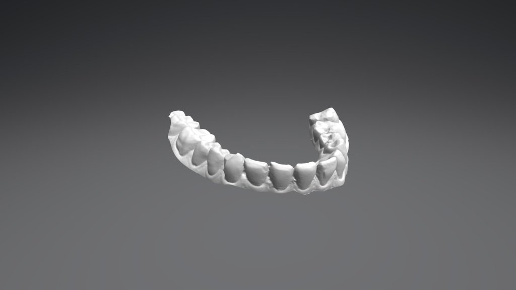 Elandra Lower Jaw