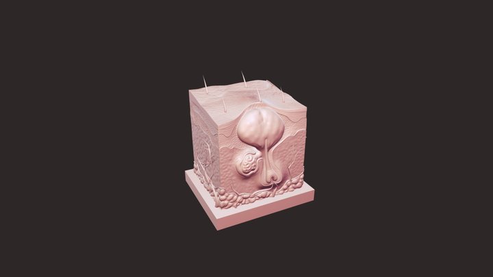 Acure skin model - Demo 3D Model