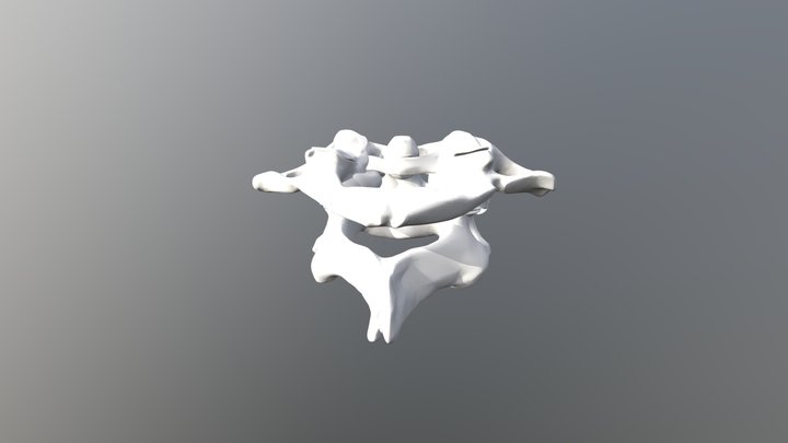 Atlanto- Axial Joint 3D Model
