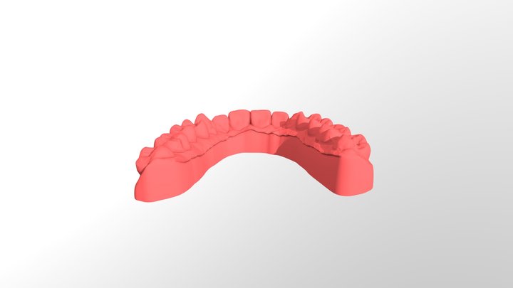 20201219_1316_Weiiss_Tomizawa_Model_UpperJaw 3D Model