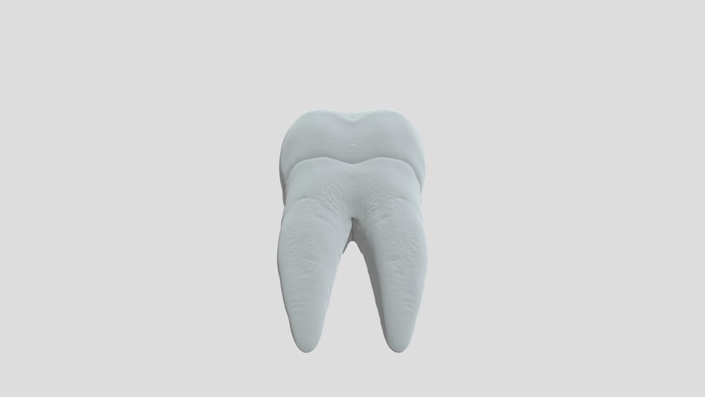 Tooth door stopper