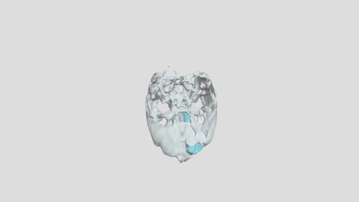 Segmentation 3D Model