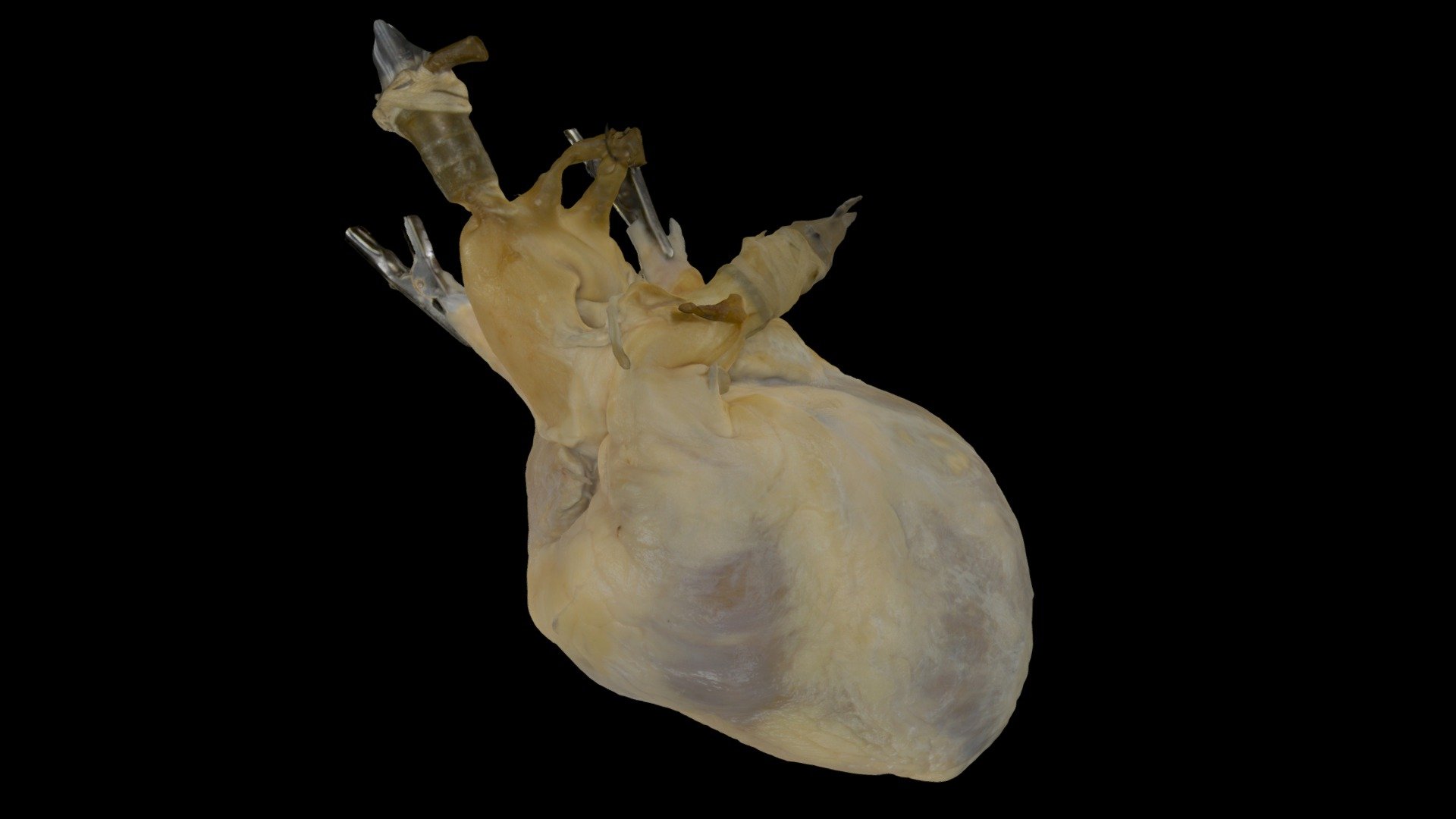 Perfusion Fixed Human Heart Long Aorta - Download Free 3D model by ...