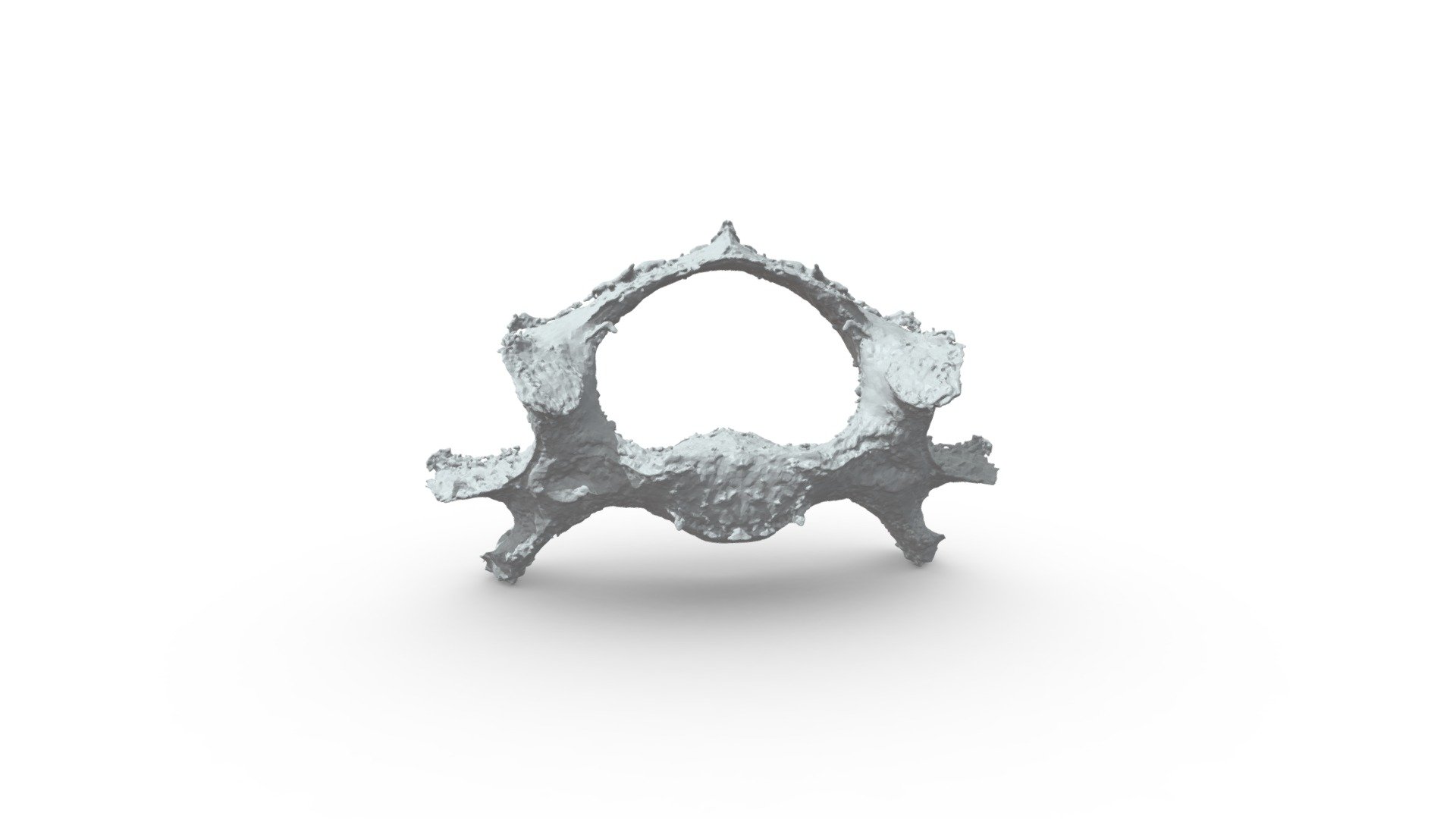 raw C6 vertebra scan