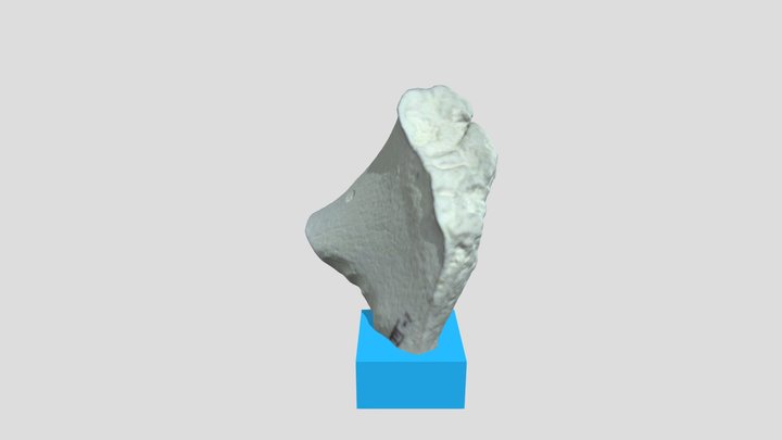 Pubic Symphysis III-1 3D Model