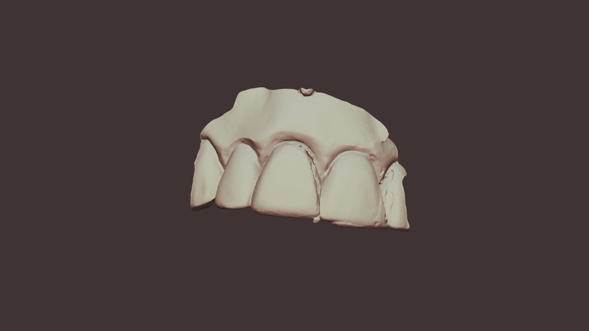 #8 Wax, Group 8, Scanner 2 Upper Jaw