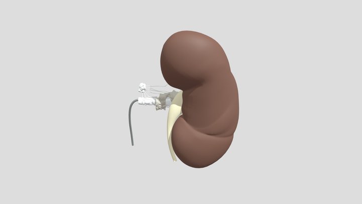 Lesion Anatomy V14 3D Model