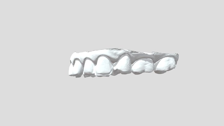 1014 Upper Jaw 3D Model