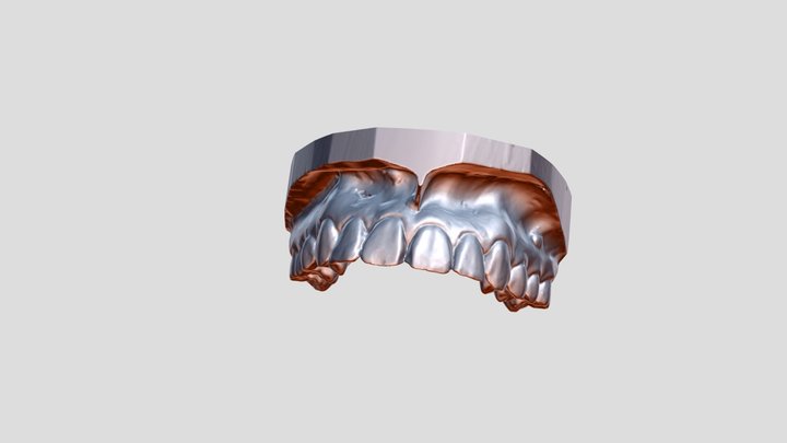 T1 3D Model