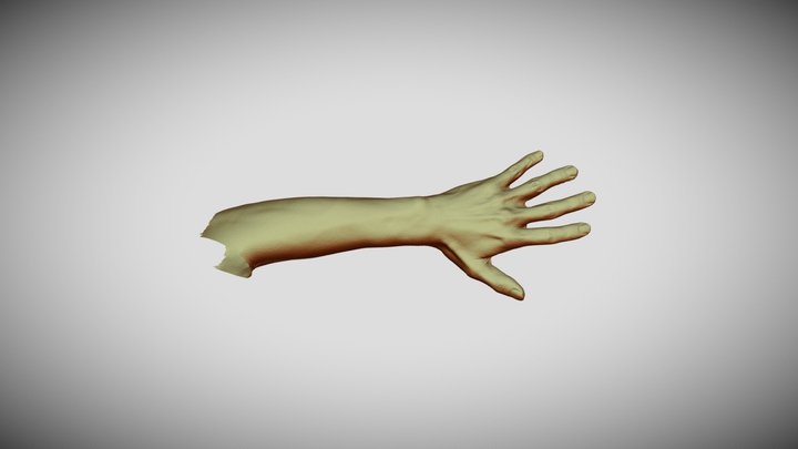 Hand Arm