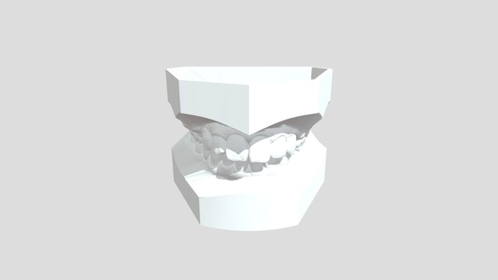 128239639_ABO_lockedocclusion_ul 3D Model