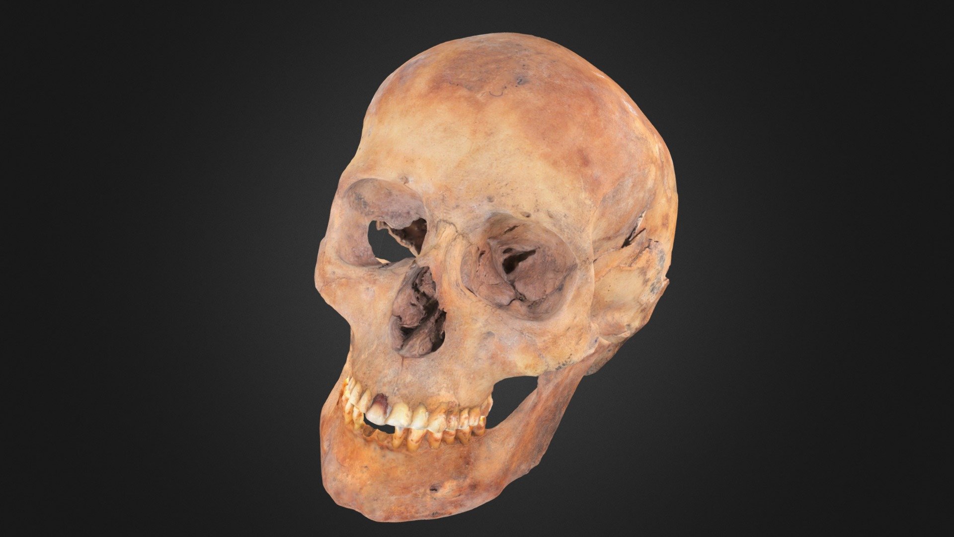 Skull 11 (Part 3: Head)