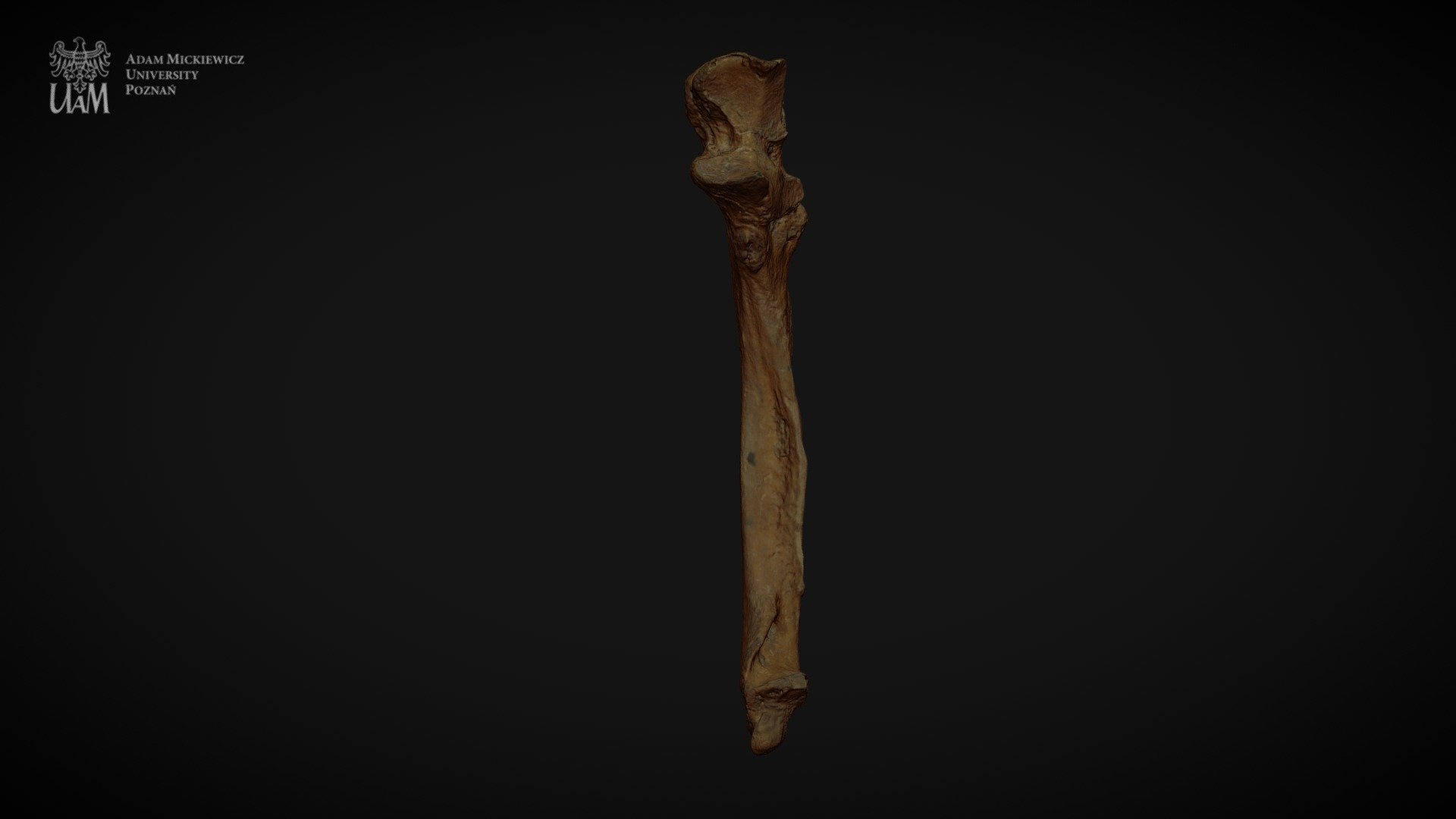 Achondroplastic dwarf - left ulna - 3D model by AMU Human Evolutionary ...