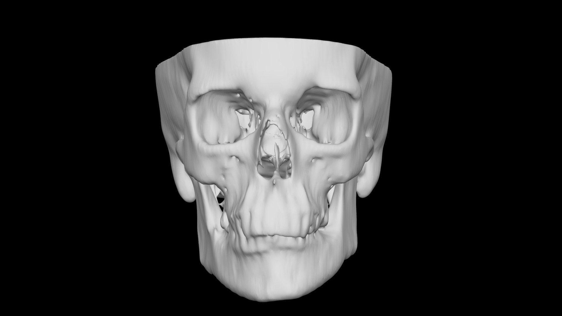 Skull Female 57yo