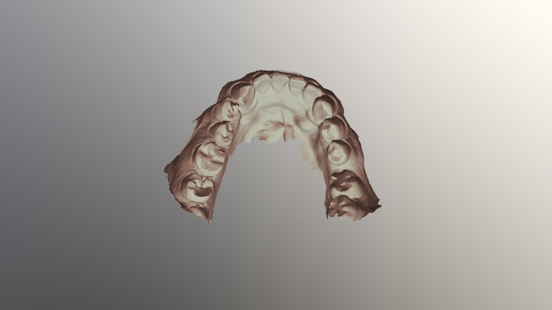 Lower Jaw Scan - 3D model by latte0126 [998a305] - Sketchfab