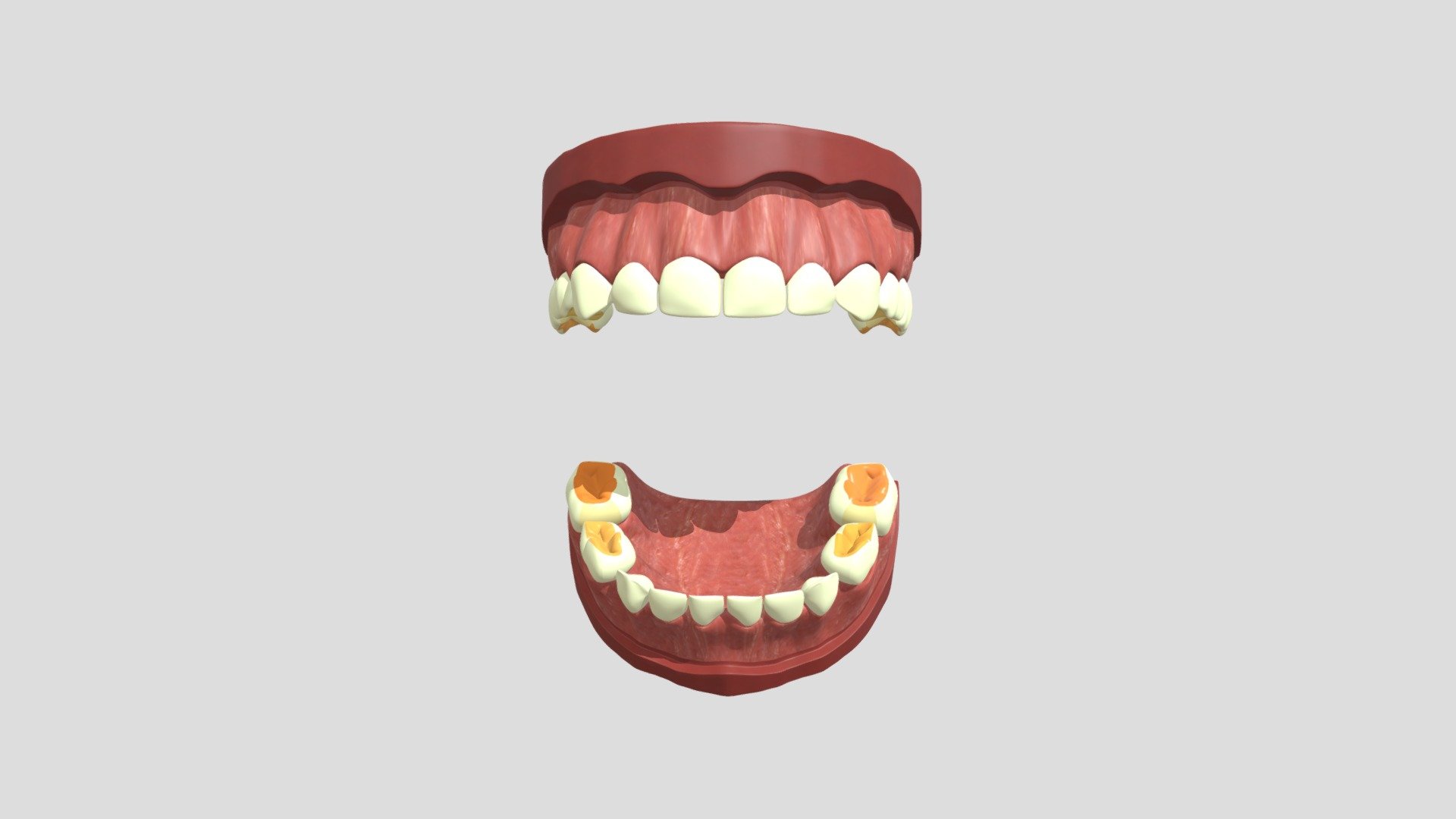 LC6_Model4