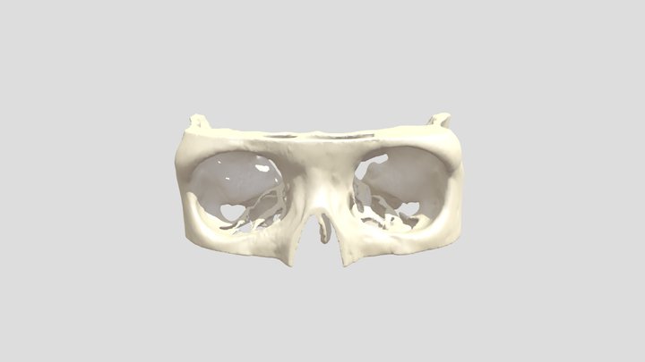 Orbital bone 3D Model