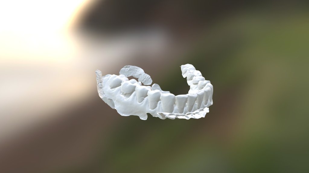 Madeleine Lower Jaw