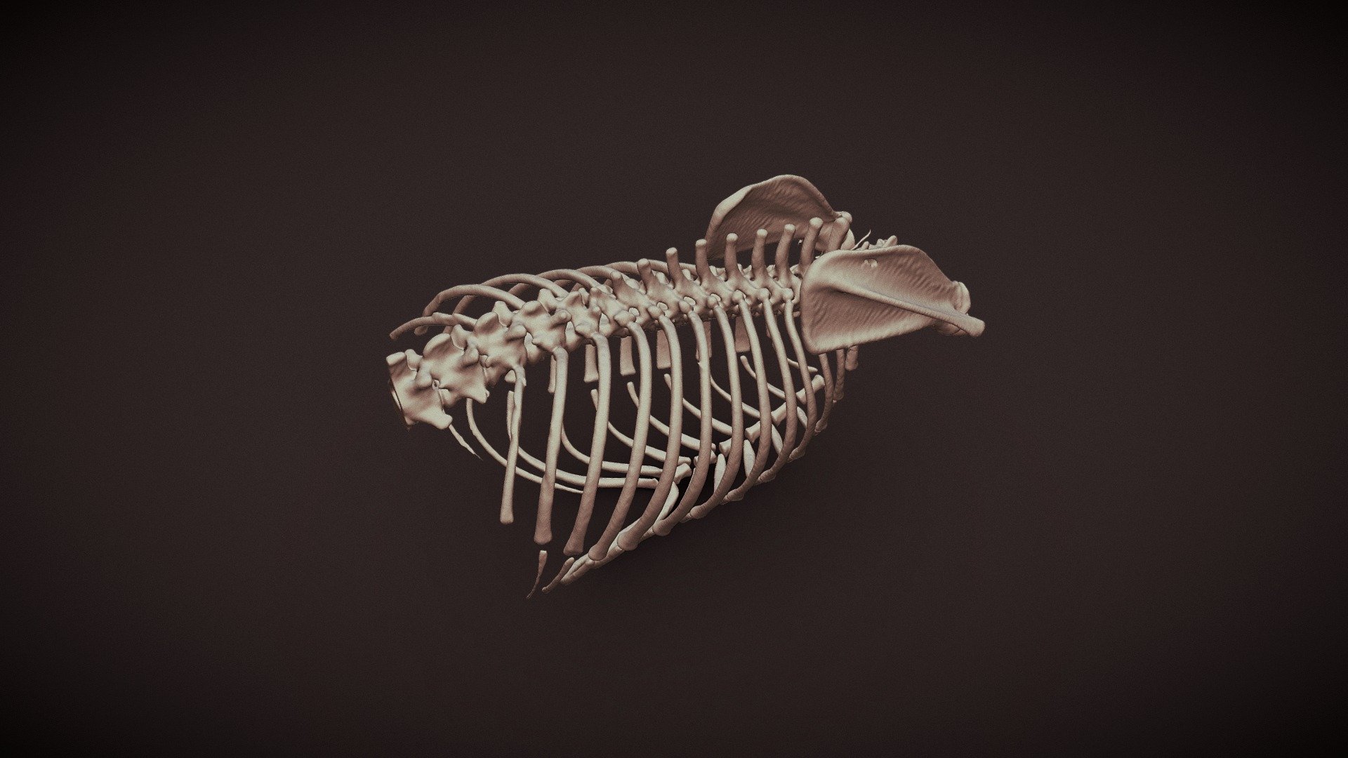 Abnormal: Skeleton