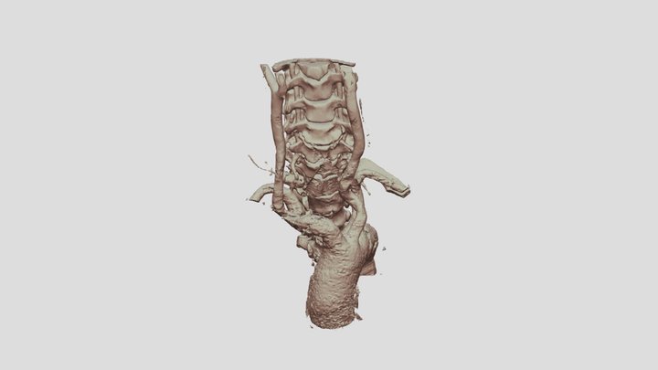 Supra-aortic arteries 3D Model