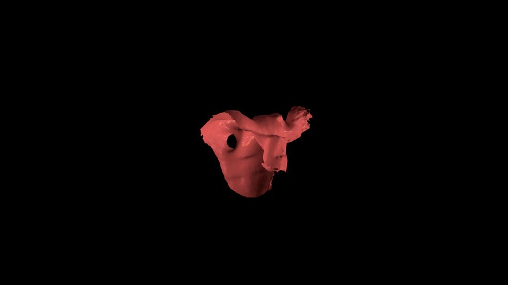 Example Left Atrial Appendage - Cutaway View - 3D model by MedScience ...