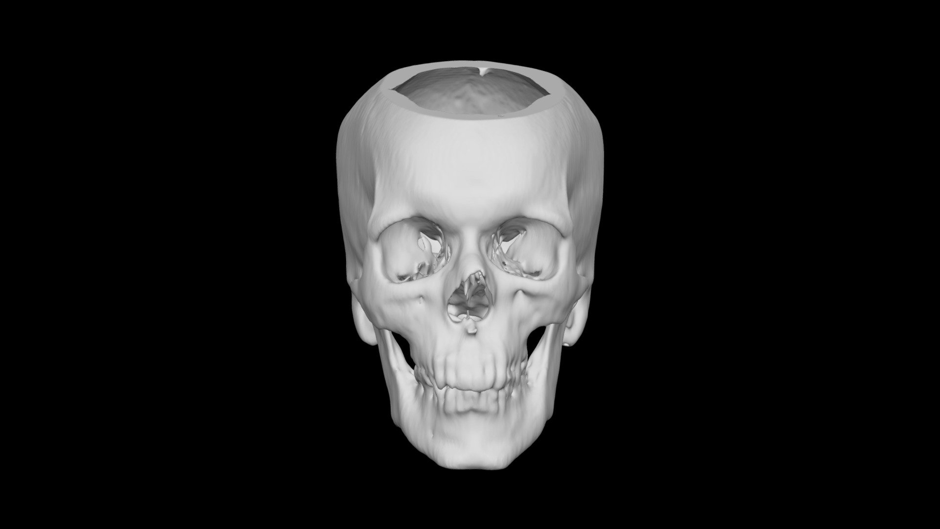 Skull Male 59yo