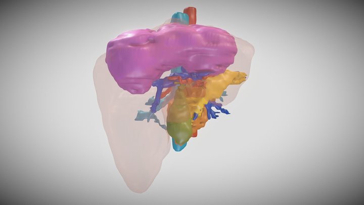 Quistes HIdatídicos Hepáticos Múltiples 3D Model