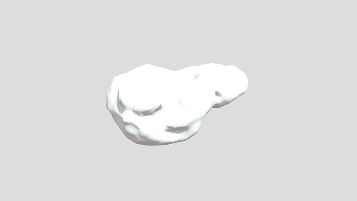 Schwannoma Vestibular