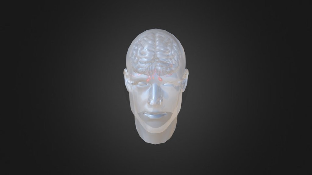 Aneurysms 1st Image