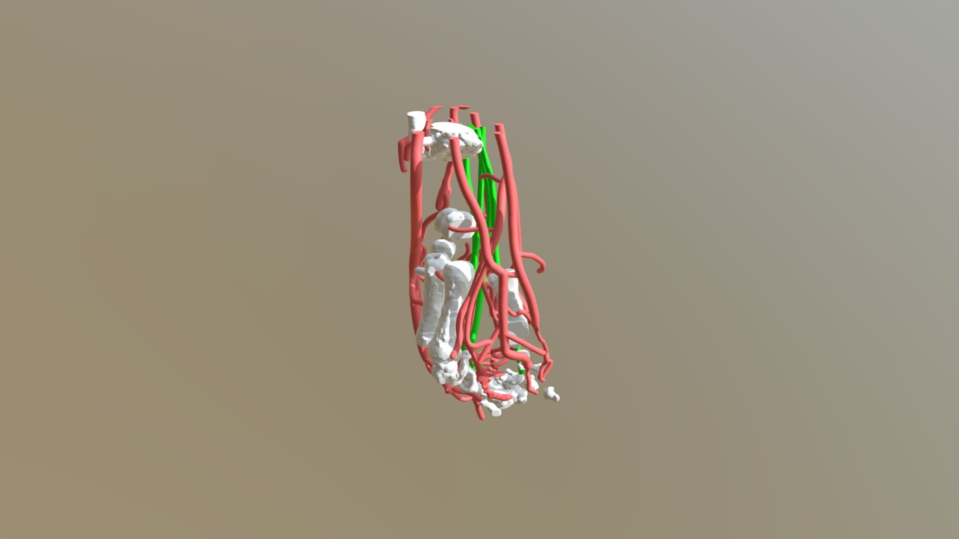 MRI Sketchfab