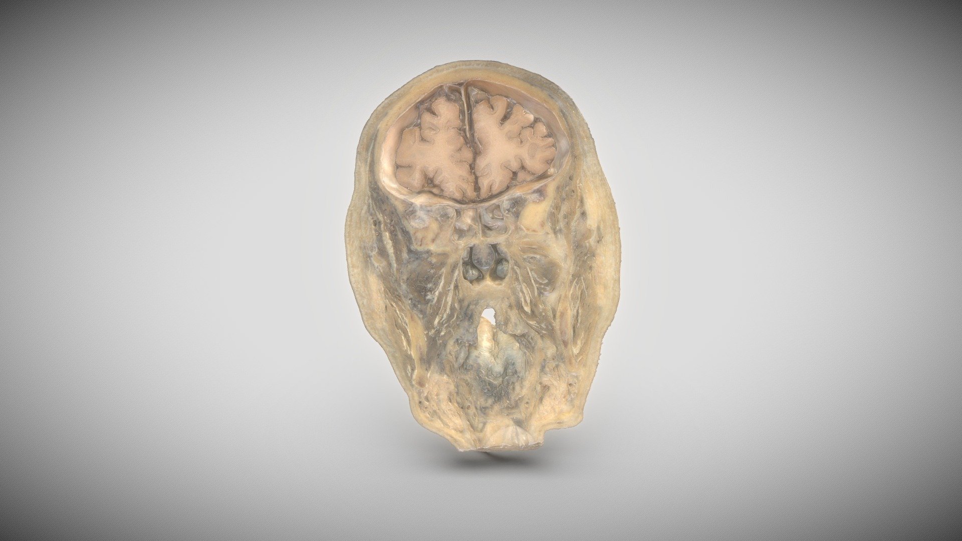 Head, frontal section_3 - 3D model by Vida_Lab [9c7352f] - Sketchfab