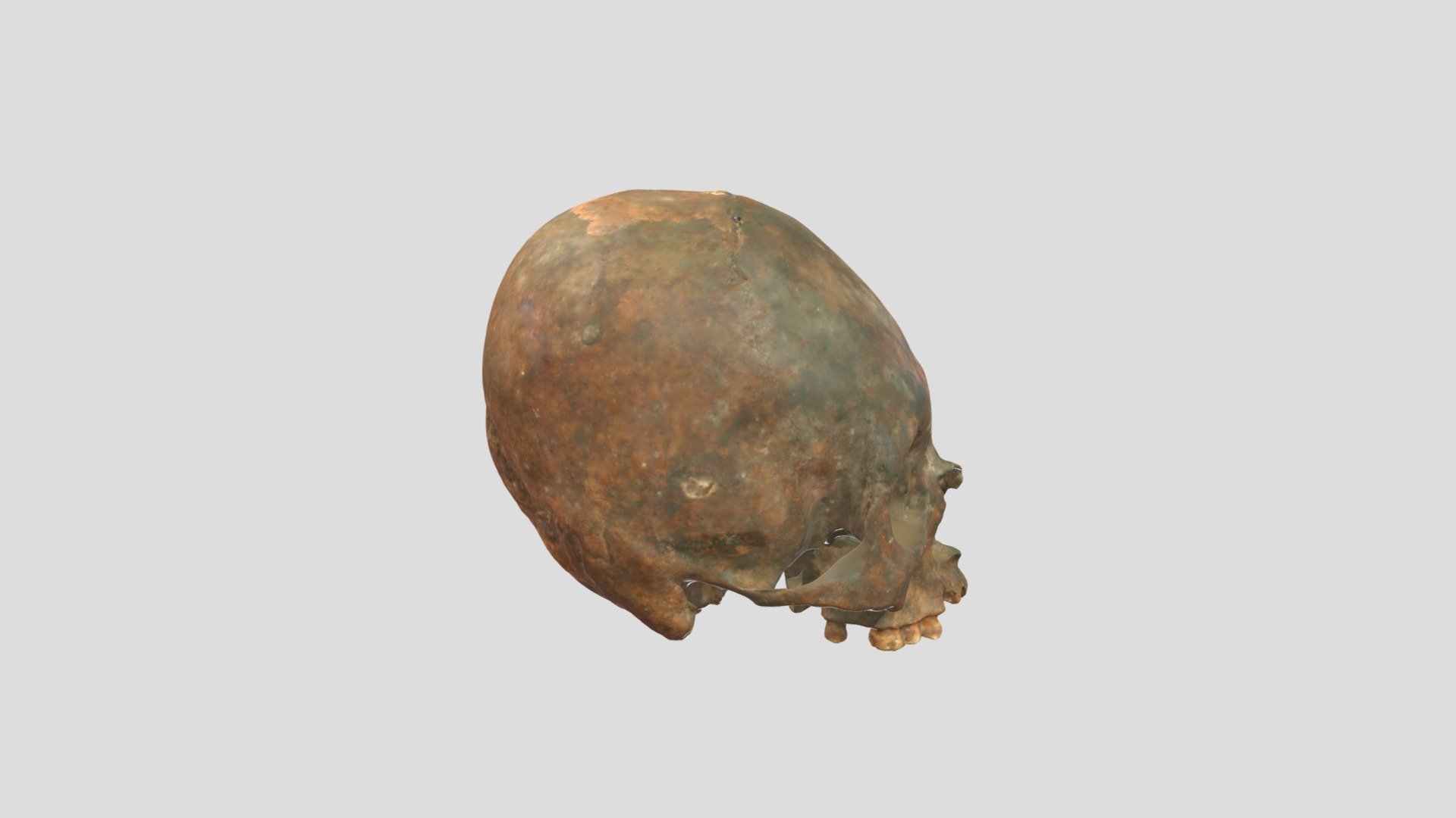 Modified Peruvian Cranium
